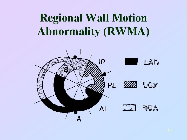 Regional Wall Motion Abnormality (RWMA) 82 