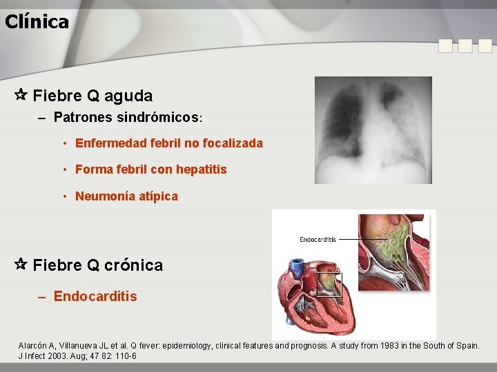 Clínica Fiebre Q aguda – Patrones sindrómicos: • Enfermedad febril no focalizada • Forma