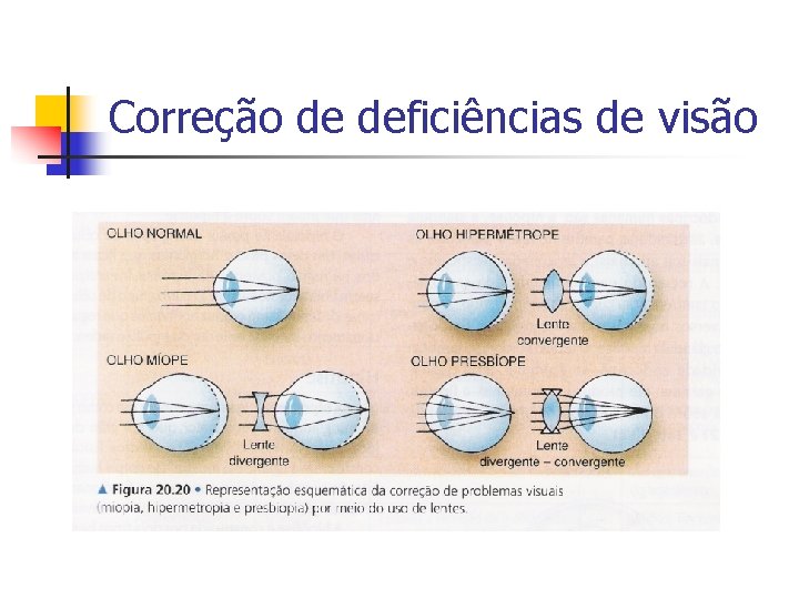 Correção de deficiências de visão 