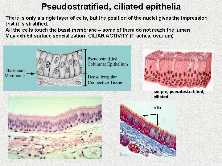 Pseudostratified, ciliated epithelia There is only a single layer of cells, but the position