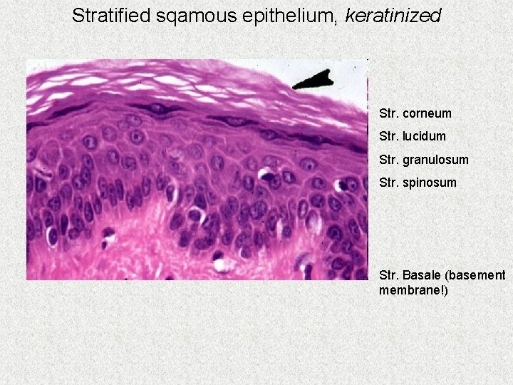 Stratified sqamous epithelium, keratinized Str. corneum Str. lucidum Str. granulosum Str. spinosum Str. Basale