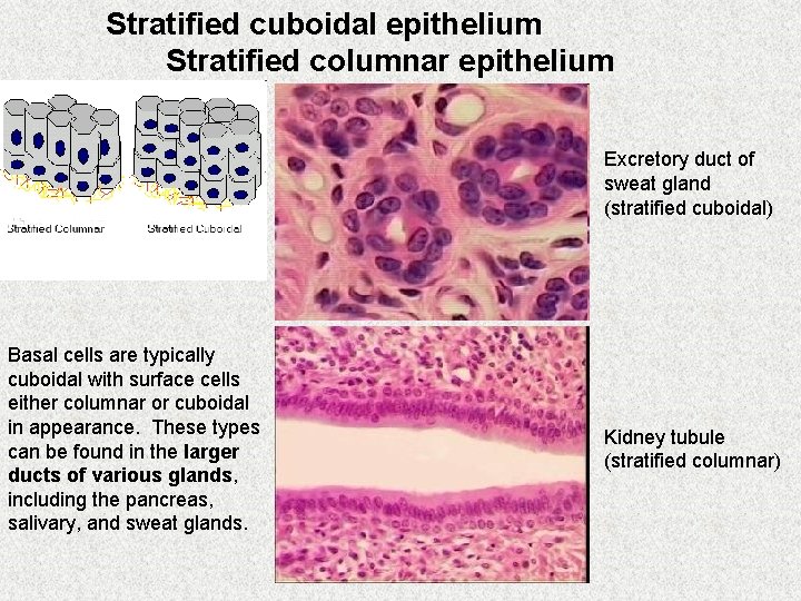 Stratified cuboidal epithelium Stratified columnar epithelium Excretory duct of sweat gland (stratified cuboidal) Basal