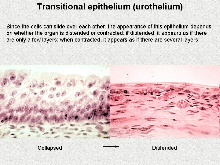 Transitional epithelium (urothelium) Since the cells can slide over each other, the appearance of