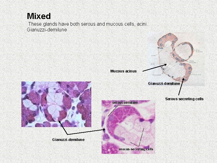 Mixed These glands have both serous and mucous cells, acini. Gianuzzi-demilune Mucous acinus Gianuzzi-demilune