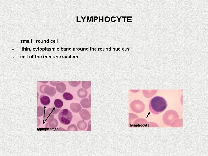 LYMPHOCYTE - small , round cell - thin, cytoplasmic band around the round nucleus