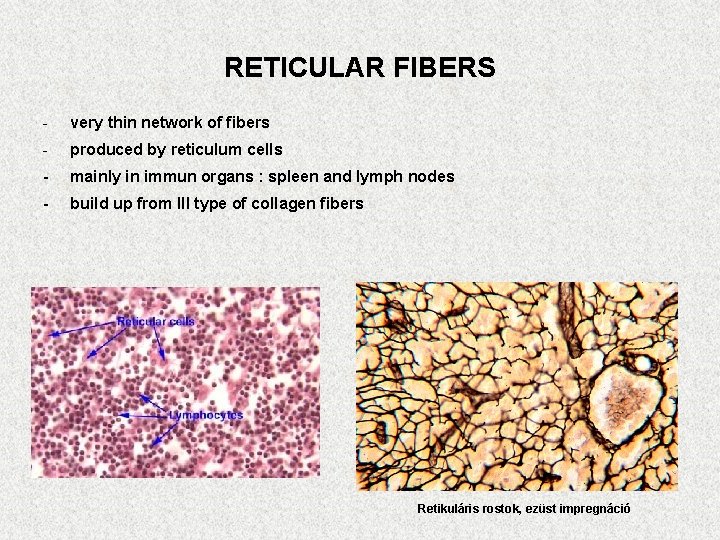 RETICULAR FIBERS - very thin network of fibers - produced by reticulum cells -