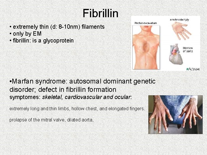 Fibrillin • extremely thin (d: 8 -10 nm) filaments • only by EM •