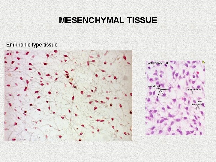 MESENCHYMAL TISSUE Embrionic type tissue 