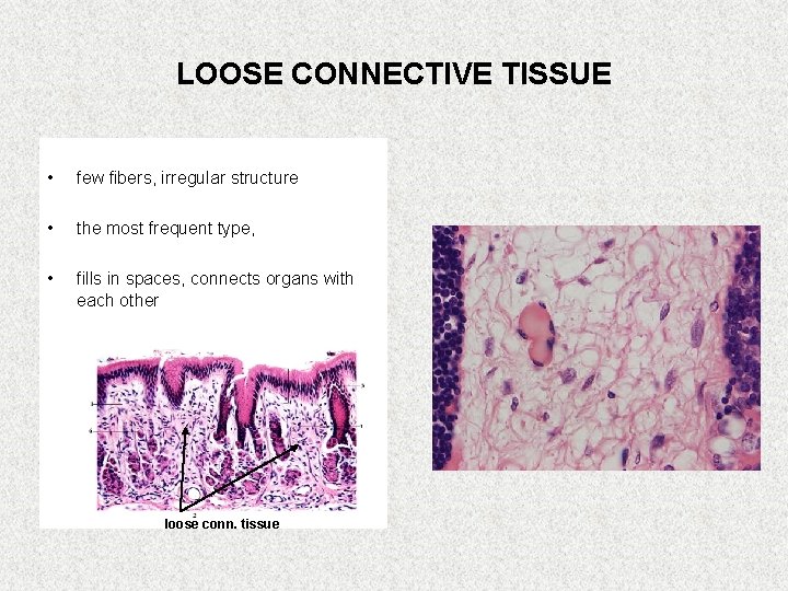 LOOSE CONNECTIVE TISSUE • few fibers, irregular structure • the most frequent type, •