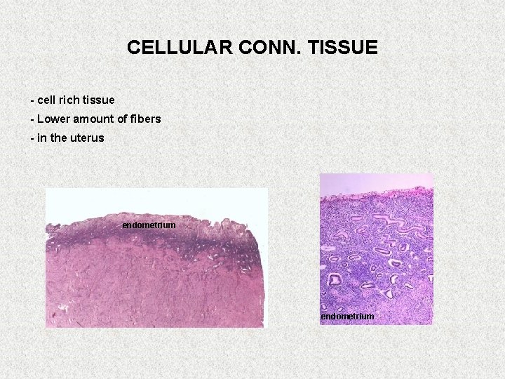 CELLULAR CONN. TISSUE - cell rich tissue - Lower amount of fibers - in