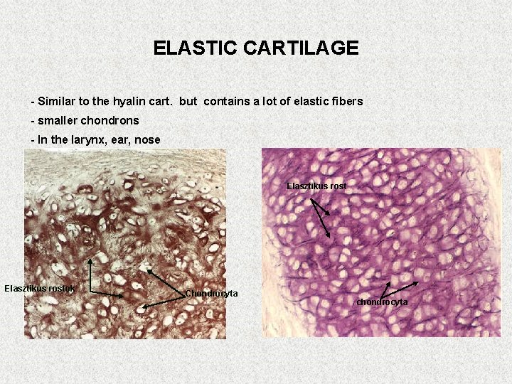ELASTIC CARTILAGE - Similar to the hyalin cart. but contains a lot of elastic