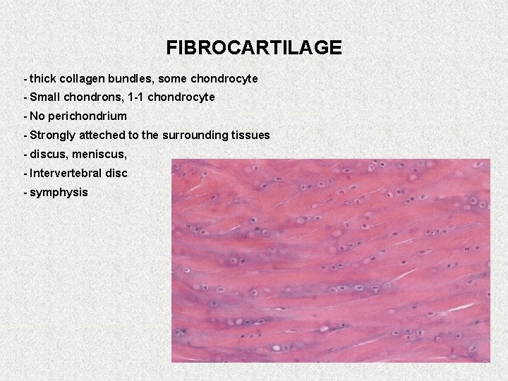 FIBROCARTILAGE - thick collagen bundles, some chondrocyte - Small chondrons, 1 -1 chondrocyte -