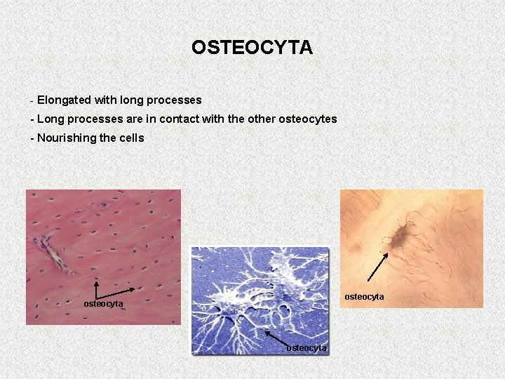 OSTEOCYTA - Elongated with long processes - Long processes are in contact with the