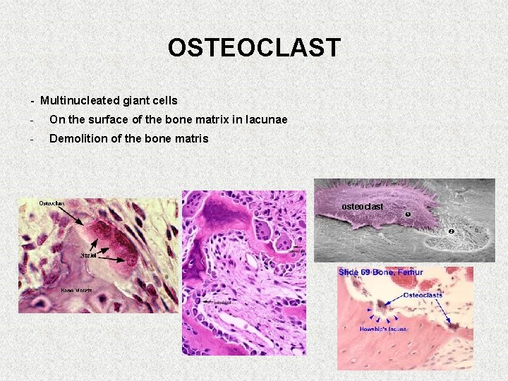 OSTEOCLAST - Multinucleated giant cells - On the surface of the bone matrix in