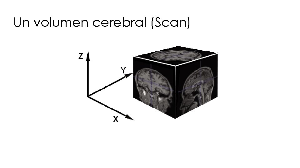 Un volumen cerebral (Scan) 