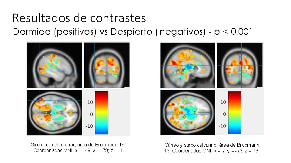 Resultados de contrastes Dormido (positivos) vs Despierto ( negativos) - p < 0. 001