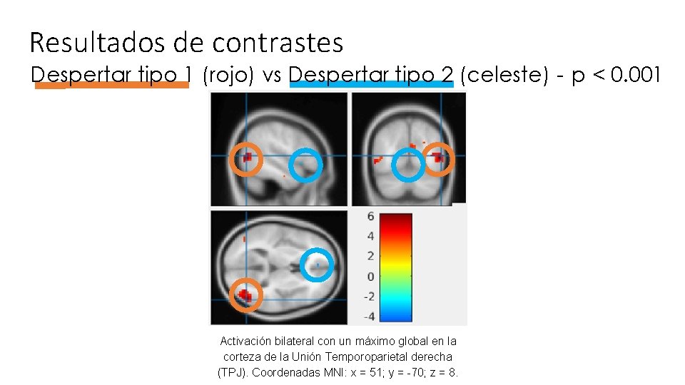 Resultados de contrastes Despertar tipo 1 (rojo) vs Despertar tipo 2 (celeste) - p