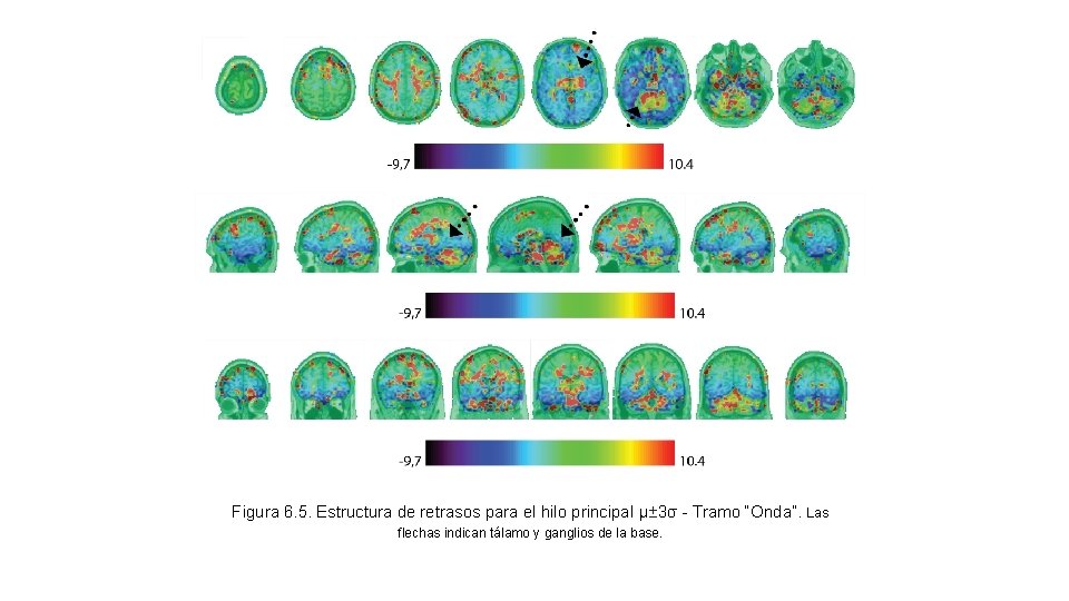 Figura 6. 5. Estructura de retrasos para el hilo principal μ± 3σ - Tramo