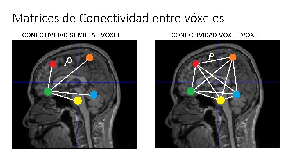 Matrices de Conectividad entre vóxeles CONECTIVIDAD SEMILLA - VOXEL CONECTIVIDAD VOXEL-VOXEL 