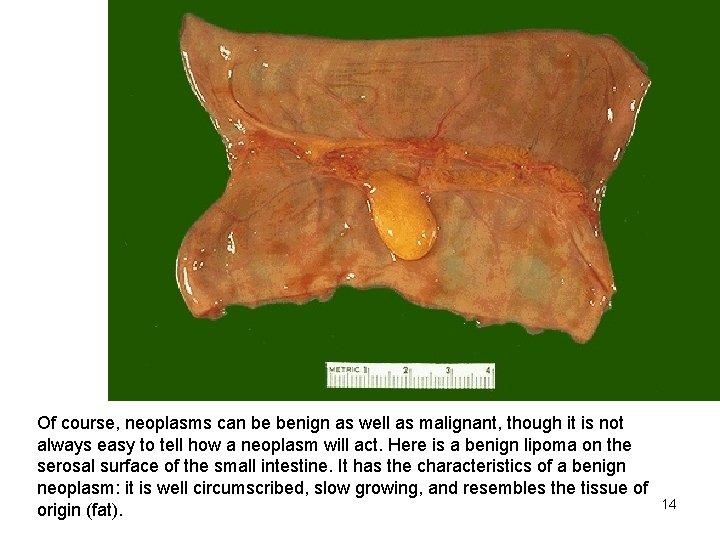 Of course, neoplasms can be benign as well as malignant, though it is not