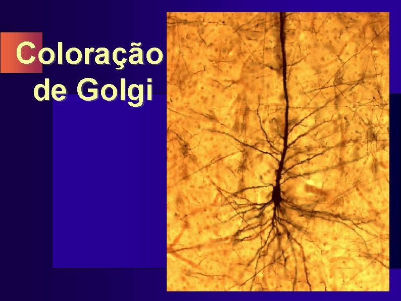 Coloração de Golgi 