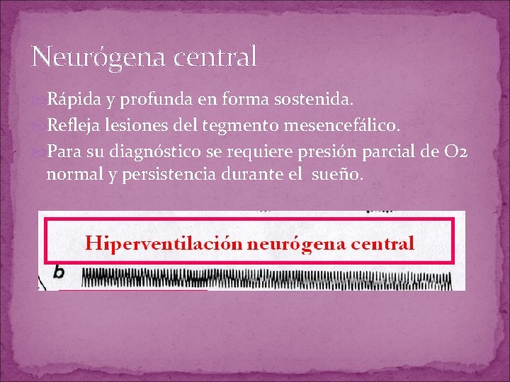 Neurógena central Rápida y profunda en forma sostenida. Refleja lesiones del tegmento mesencefálico. Para Neurógena central Rápida y profunda en forma sostenida. Refleja lesiones del tegmento mesencefálico. Para