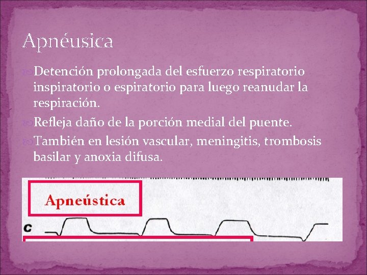 Apnéusica Detención prolongada del esfuerzo respiratorio inspiratorio o espiratorio para luego reanudar la respiración. Apnéusica Detención prolongada del esfuerzo respiratorio inspiratorio o espiratorio para luego reanudar la respiración.