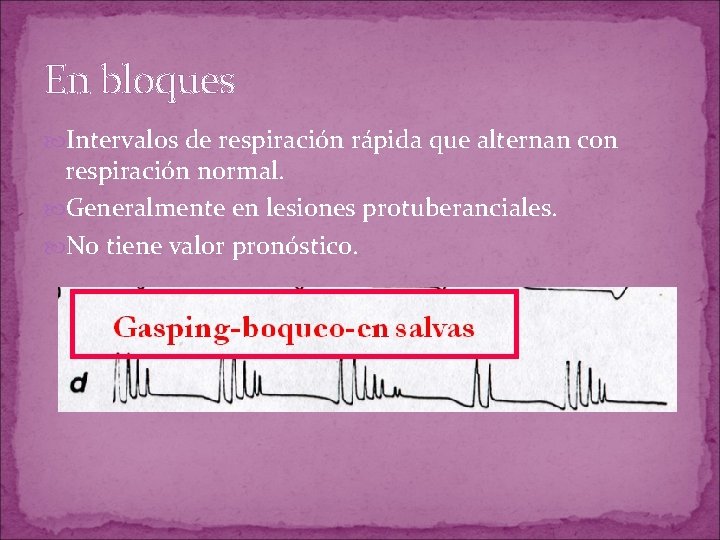 En bloques Intervalos de respiración rápida que alternan con respiración normal. Generalmente en lesiones En bloques Intervalos de respiración rápida que alternan con respiración normal. Generalmente en lesiones
