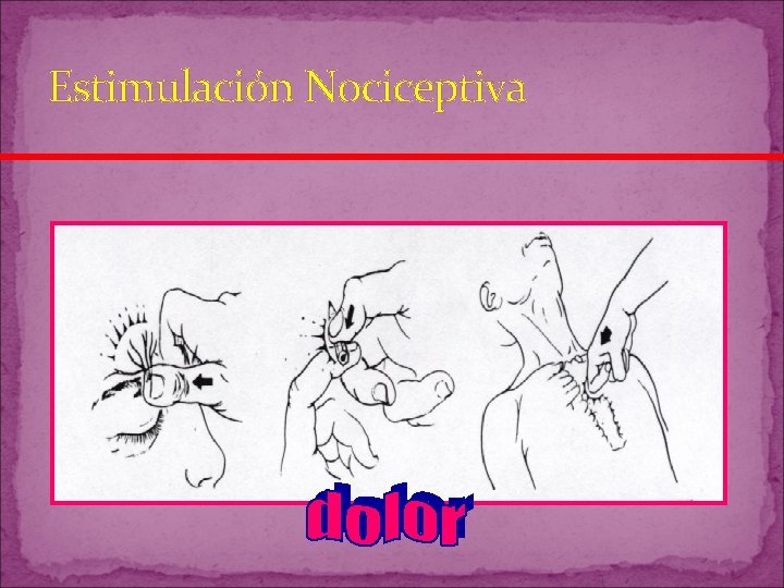 Estimulación Nociceptiva Estimulación Nociceptiva