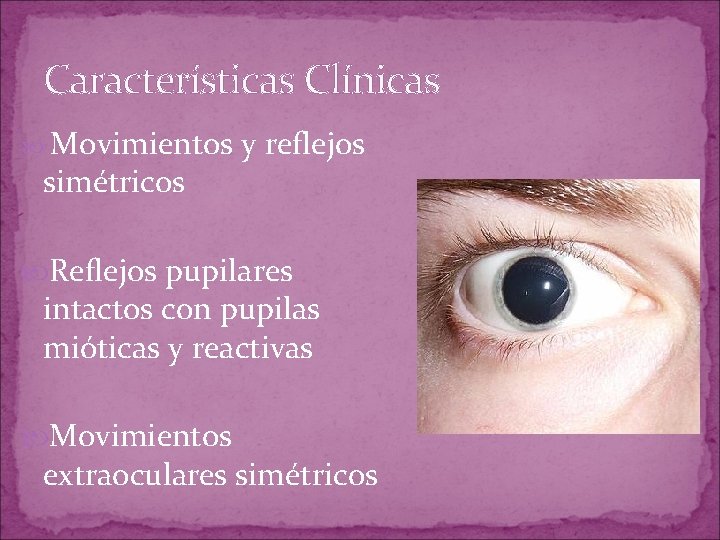 Características Clínicas Movimientos simétricos y reflejos Reflejos pupilares intactos con pupilas mióticas y reactivas Características Clínicas Movimientos simétricos y reflejos Reflejos pupilares intactos con pupilas mióticas y reactivas