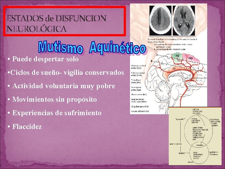 ESTADOS de DISFUNCION NEUROLÓGICA • Puede despertar solo • Ciclos de sueño- vigilia conservados ESTADOS de DISFUNCION NEUROLÓGICA • Puede despertar solo • Ciclos de sueño- vigilia conservados
