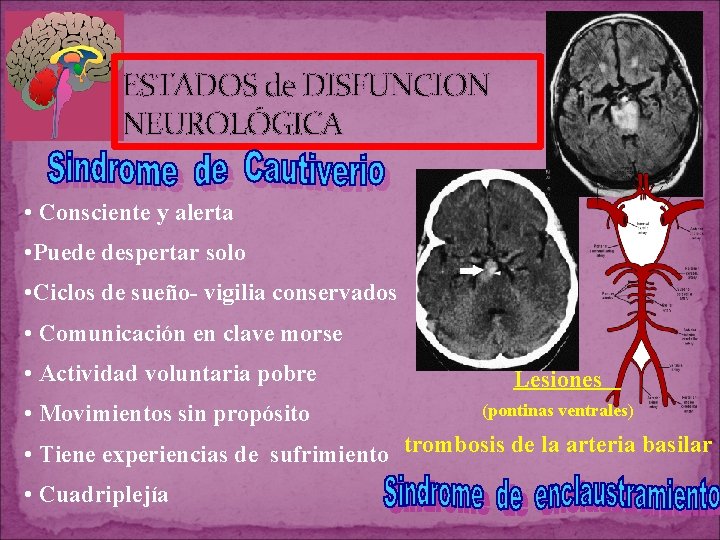 ESTADOS de DISFUNCION NEUROLÓGICA • Consciente y alerta • Puede despertar solo • Ciclos ESTADOS de DISFUNCION NEUROLÓGICA • Consciente y alerta • Puede despertar solo • Ciclos