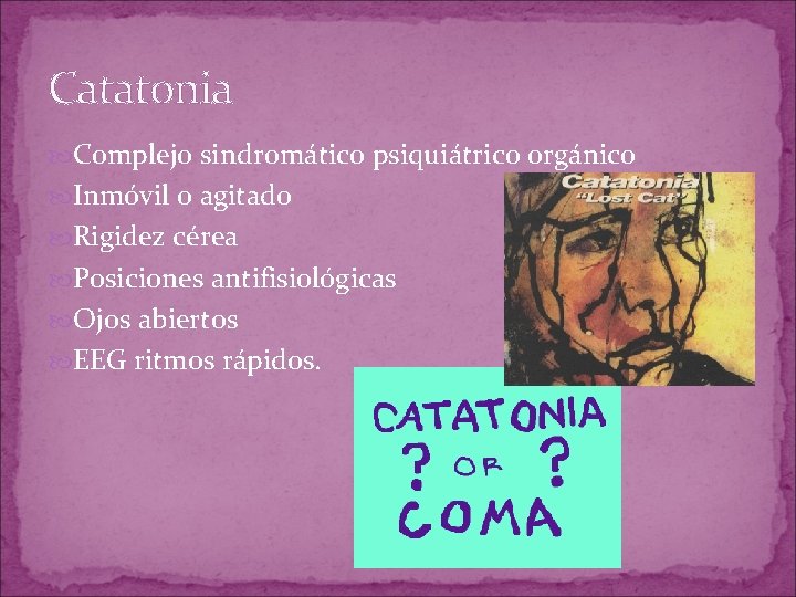 Catatonia Complejo sindromático psiquiátrico orgánico Inmóvil o agitado Rigidez cérea Posiciones antifisiológicas Ojos abiertos Catatonia Complejo sindromático psiquiátrico orgánico Inmóvil o agitado Rigidez cérea Posiciones antifisiológicas Ojos abiertos