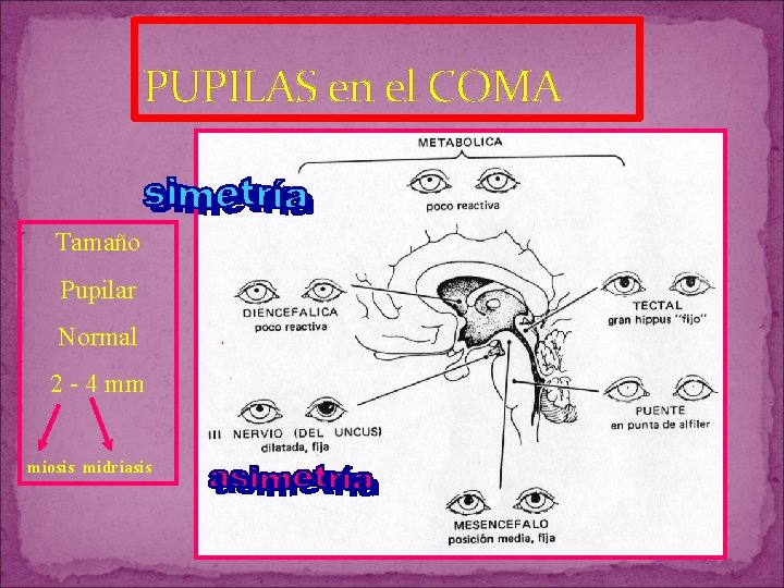 PUPILAS en el COMA Tamaño Pupilar Normal 2 - 4 mm miosis midriasis PUPILAS en el COMA Tamaño Pupilar Normal 2 - 4 mm miosis midriasis
