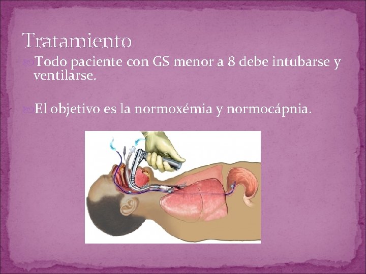 Tratamiento Todo paciente con GS menor a 8 debe intubarse y ventilarse. El objetivo Tratamiento Todo paciente con GS menor a 8 debe intubarse y ventilarse. El objetivo