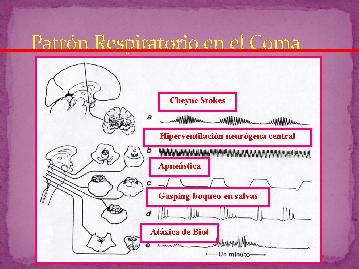 Patrón Respiratorio en el Coma Cheyne Stokes Hiperventilación neurógena central Apneústica Gasping-boqueo-en salvas Atáxica Patrón Respiratorio en el Coma Cheyne Stokes Hiperventilación neurógena central Apneústica Gasping-boqueo-en salvas Atáxica