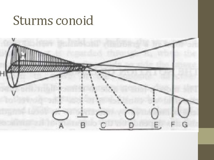 Sturms conoid 