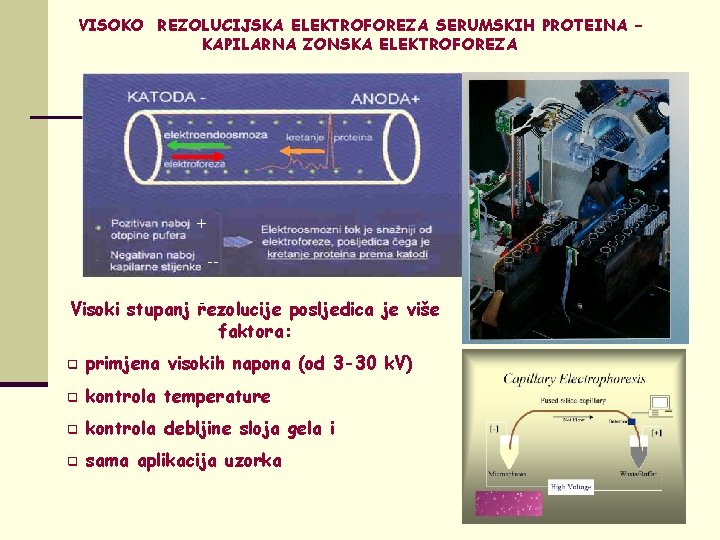 VISOKO REZOLUCIJSKA ELEKTROFOREZA SERUMSKIH PROTEINA – KAPILARNA ZONSKA ELEKTROFOREZA + -Visoki stupanj rezolucije posljedica