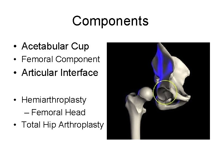 Components • Acetabular Cup • Femoral Component • Articular Interface • Hemiarthroplasty – Femoral