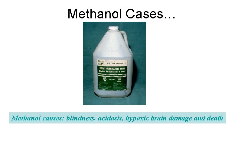 Methanol Cases… Methanol causes: blindness, acidosis, hypoxic brain damage and death 