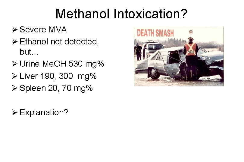 Methanol Intoxication? Ø Severe MVA Ø Ethanol not detected, but… Ø Urine Me. OH