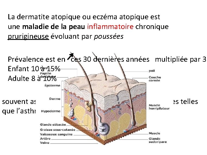 La dermatite atopique ou eczéma atopique est une maladie de la peau inflammatoire chronique