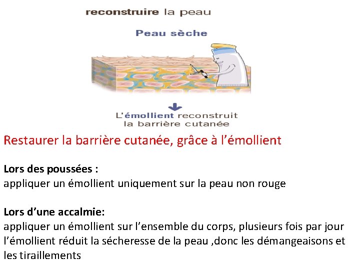 Restaurer la barrière cutanée, grâce à l’émollient Lors des poussées : appliquer un émollient