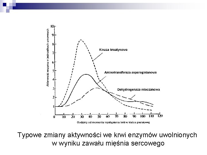 Typowe zmiany aktywności we krwi enzymów uwolnionych w wyniku zawału mięśnia sercowego 