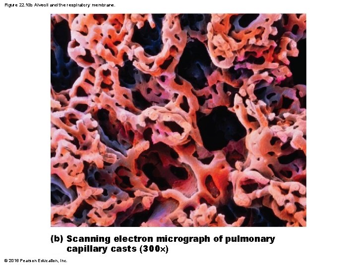 Figure 22. 10 b Alveoli and the respiratory membrane. Scanning electron micrograph of pulmonary