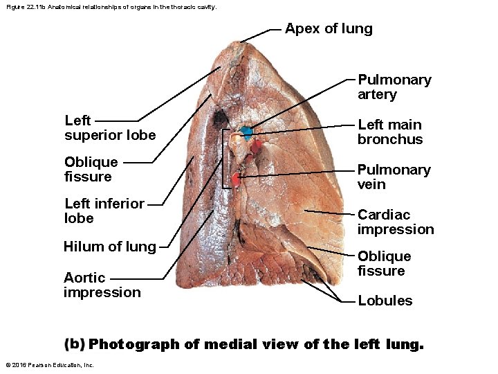 Figure 22. 11 b Anatomical relationships of organs in the thoracic cavity. Apex of