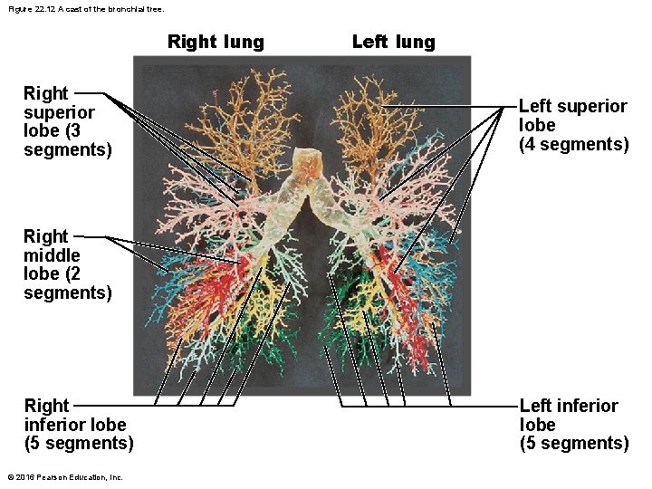 Figure 22. 12 A cast of the bronchial tree. Right lung Right superior lobe