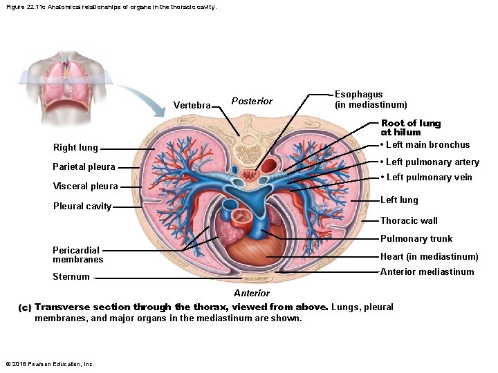 Figure 22. 11 c Anatomical relationships of organs in the thoracic cavity. Vertebra Posterior