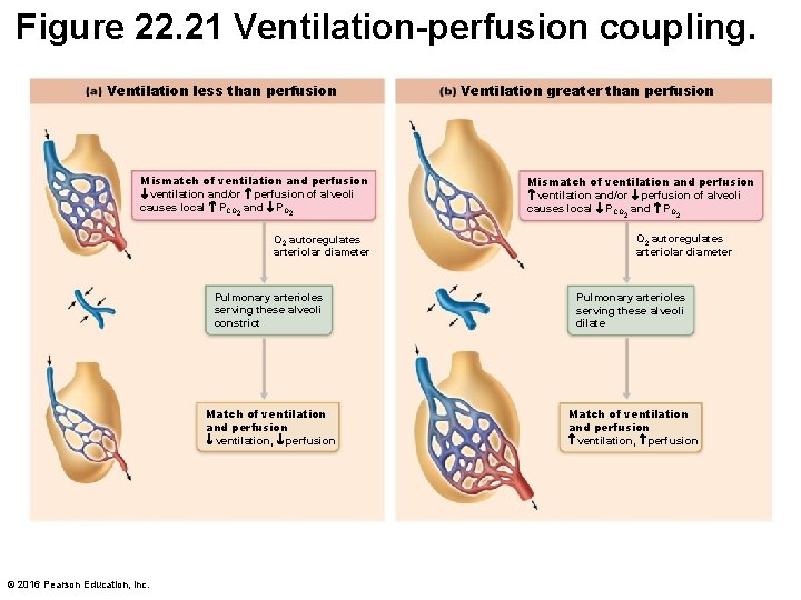 Figure 22. 21 Ventilation-perfusion coupling. Ventilation less than perfusion Mismatch of ventilation and perfusion