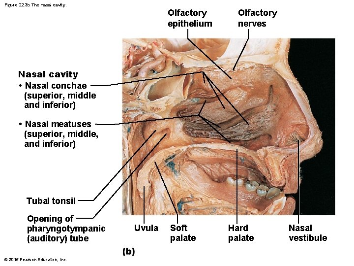 Figure 22. 3 b The nasal cavity. Olfactory epithelium Olfactory nerves Nasal cavity •